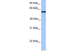 WB Suggested Anti-MLLT3 Antibody Titration:  0. (AF9 抗体  (N-Term))