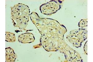 Immunohistochemistry of paraffin-embedded human placenta tissue using ABIN7170991 at dilution of 1:100 (SOCS1 抗体  (AA 1-211))