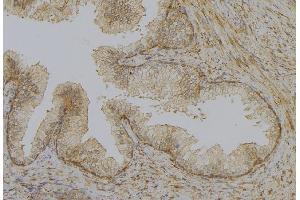 ABIN6277903 at 1/100 staining Mouse colon tissue by IHC-P. (UCP1 抗体  (Internal Region))