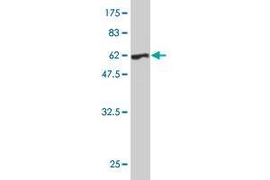 Western Blotting (WB) image for anti-Protein Kinase, Interferon-Inducible Double Stranded RNA Dependent Activator (PRKRA) (AA 1-313) antibody (ABIN563706)
