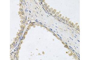Immunohistochemistry of paraffin-embedded Human prostate using POMGNT1 Polyclonal Antibody at dilution of 1:100 (40x lens). (POMGNT1 抗体)