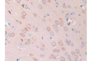 Detection of Slit1 in Rat Cerebrum Tissue using Polyclonal Antibody to Slit Homolog 1 (Slit1)