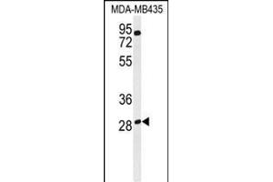 Western blot analysis of RRAGD Antibody (Center) (ABIN651150 and ABIN2840101) in MDA-M cell line lysates (35 μg/lane).