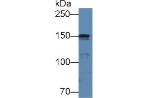 Detection of COL4a5 in Porcine Cerebrum lysate using Polyclonal Antibody to Collagen Type IV Alpha 5 (COL4a5) (COL4a5 抗体  (AA 1461-1685))