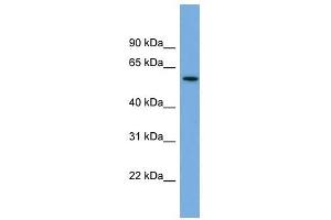 AK5 antibody used at 1 ug/ml to detect target protein. (Adenylate Kinase 5 抗体  (N-Term))