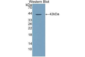 Western blot analysis of the recombinant protein. (XCL1 抗体  (AA 23-113))
