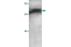 Western blot analysis of human fetal brain lysate with ADAM10 polyclonal antibody  at 1 : 1000 dilution.