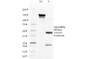 SDS-PAGE Analysis Purified Aurora B Mouse Monoclonal Antibody (AURKB/1592). (Aurora Kinase B 抗体  (AA 89-251))
