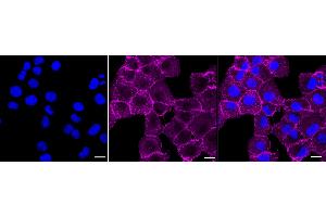 Immunocytochemical staining of HT- cells with PAG1 antibody (ABIN7799831), 1:1,000). (Recombinant PAG1 抗体)