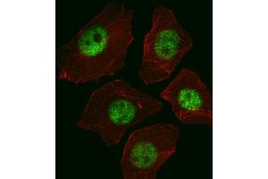 Fluorescent image of A549 cell stained with SOX2 Antibody (ABIN387798 and ABIN2843854)/SG110310. (SOX2 抗体)