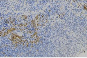 ABIN6277802 at 1/100 staining Human lymph node tissue by IHC-P. (S100A9 抗体)