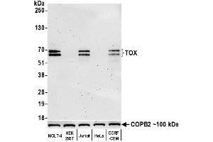Western Blotting (WB) image for anti-Thymus High Mobility Group Box Protein (TOX) (AA 50-100) antibody (ABIN7453374) (Recombinant TOX 抗体  (AA 50-100))