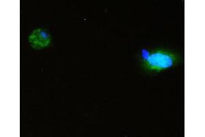 IF analysis of SQSTM1 using anti-SQSTM1 antibody (ABIN3043937).