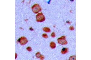 Immunohistochemical analysis of GAP43 staining in human brain formalin fixed paraffin embedded tissue section. (GAP43 抗体  (N-Term))