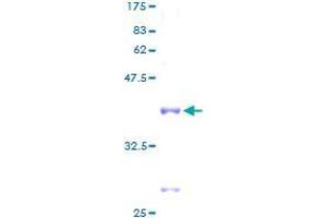 Image no. 1 for Ribosomal Protein L35 (RPL35) protein (GST tag) (ABIN1318618) (RPL35 Protein (GST tag))