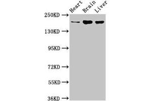 Western Blot Positive WB detected in: Rat heart tissue, Mouse brain tissue, Mouse liver tissue All lanes: ARFGEF2 antibody at 3. (ARFGEF2 抗体  (AA 200-317))