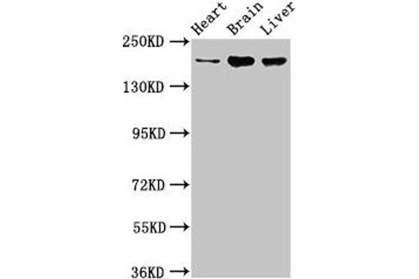 ARFGEF2 抗体  (AA 200-317)