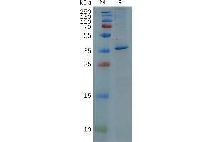 SDS-PAGE (SDS) image for Glial Fibrillary Acidic Protein (GFAP) (AA 68-377) protein (His tag) (ABIN7092819)