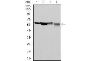 Glucose-6-Phosphate Dehydrogenase 抗体