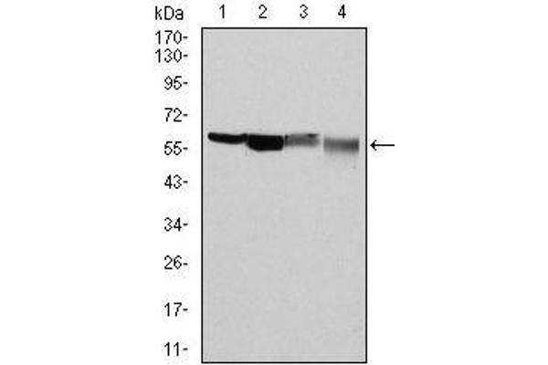 Glucose-6-Phosphate Dehydrogenase 抗体