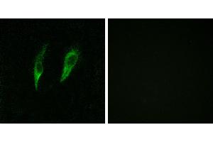 Peptide - +Immunofluorescence analysis of HeLa cells, using IRAK3 antibody. (IRAK3 抗体)