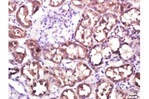 Paraformaldehyde-fixed, paraffin embedded human kidney, Antigen retrieval by boiling in sodium citrate buffer (pH6. (SLC10A2 抗体  (AA 131-230))