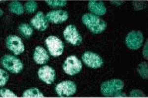 Immunofluorescence staining of A431 cells (Human epithelial carcinoma, ATCC CRL-1555). (CTCF 抗体  (AA 184-290))