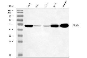 Western blot analysis of PPAR alpha/PPARA using anti-PPAR alpha/PPARA antibody (ABIN7599384).