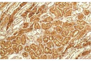 Immunohistochemistry of paraffin-embedded Human kidney tissue using IL8 Monoclonal Antibody at dilution of 1:200. (IL-8 抗体)