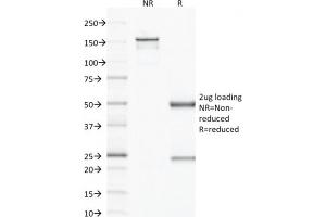 SDS-PAGE Analysis Purified VEGF Mouse Monoclonal Antibody (VG1).