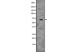 Western Blotting (WB) image for anti-Interleukin 1 Receptor, Type I (IL1R1) (C-Term) antibody (ABIN6262548)