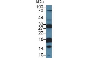 Detection of KLK13 in Rat Prostate lysate using Polyclonal Antibody to Kallikrein 13 (KLK13) (Kallikrein 13 抗体  (AA 25-261))