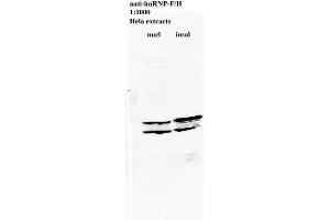 Western blot of anti-hnRNP-F/H on HeLa cell extract (HNRNPL 抗体)