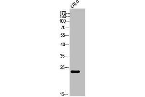 Western Blot analysis of COLO cells using CaBP7 Polyclonal Antibody (CABP7 抗体  (N-Term))