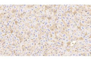 Immunohistochemistry (IHC) image for anti-Hemoglobin beta (HBB) (AA 1-147) antibody (ABIN7437341)