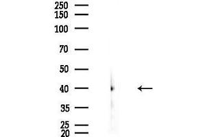 Western blot analysis of lysates from EC304 cells, using GN Antibody at 1/1000 dilution.