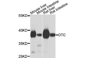 Western blot analysis of extracts of various cell lines, using OTC antibody (ABIN6003566) at 1/1000 dilution. (OTC 抗体)