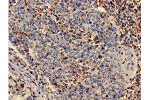 Immunohistochemistry (IHC) image for anti-Plastin 3 (PLS3) (AA 310-455) antibody (ABIN7163564)