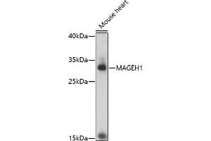 Western blot analysis of extracts of mouse heart, using M antibody (ABIN7268457) at 1:1000 dilution. (MAGEH1 抗体  (AA 10-90))