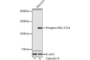 Western blot analysis of extracts of NIH/3T3 cells, using Phospho-IRE1-S724 antibody  at 1:500 dilution. (ERN1 抗体  (pSer724))