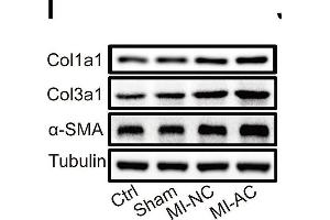 Activated CD4+ T cells-derived exosomes deteriorate cardiac function post-MI in mouse. (COL3A1 抗体  (AA 1217-1466))