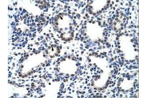 Image no. 1 for anti-Cysteinyl-tRNA Synthetase (CARS) (AA 31-80) antibody (ABIN6736227) (CARS 抗体  (AA 31-80))