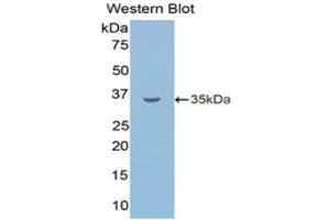 Western Blotting (WB) image for anti-Lipolysis Stimulated Lipoprotein Receptor (LSR) (AA 335-589) antibody (ABIN1859717) (LSR 抗体  (AA 335-589))