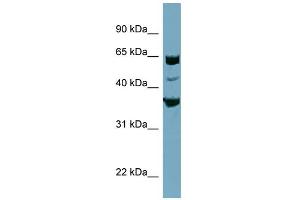 WB Suggested Anti-SEC22C Antibody Titration:  0. (SEC22C 抗体  (Middle Region))