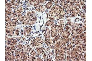 Image no. 1 for anti-Parvin, alpha (PARVA) antibody (ABIN1496443) (Parvin alpha 抗体)