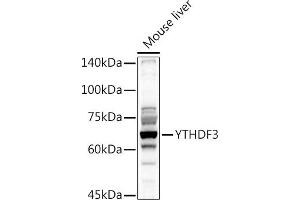 Western blot analysis of extracts of Mouse liver, using YTHDF3 antibody (ABIN6130934, ABIN6150345, ABIN6150346 and ABIN6224441) at 1:1000 dilution. (YTHDF3 抗体  (AA 1-275))