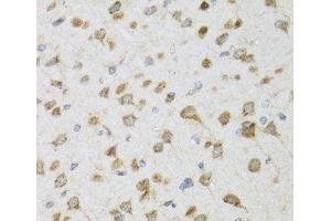 Immunohistochemistry of paraffin-embedded Rat brain using PI3 Polyclonal Antibody at dilution of 1:100 (40x lens). (PI3 抗体)