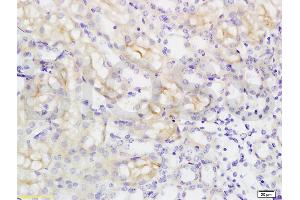 Immunohistochemistry (IHC) image for anti-Solute Carrier Family 16 (Monocarboxylic Acid Transporters), Member 3 (SLC16A3) (AA 401-465) antibody (ABIN749303)