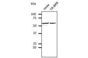 Anti-EEAI Ab at 1/500 dilution, Rabbit polyclonal to goat lµg (HRP) at 1/10,000 dilution, (PDIA3 抗体  (C-Term))