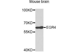 Western blot analysis of extracts of Mouse brain cells, using EGR4 antibody. (EGR4 抗体)